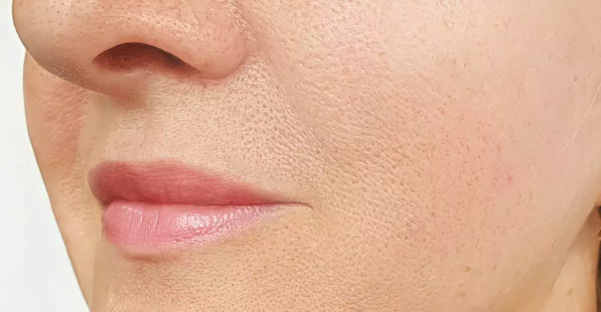 Facial Aesthetics After 03