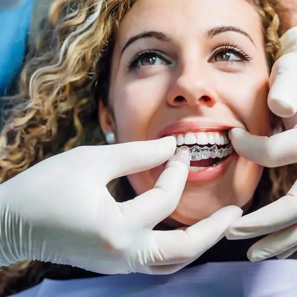 Invisalign smile 02