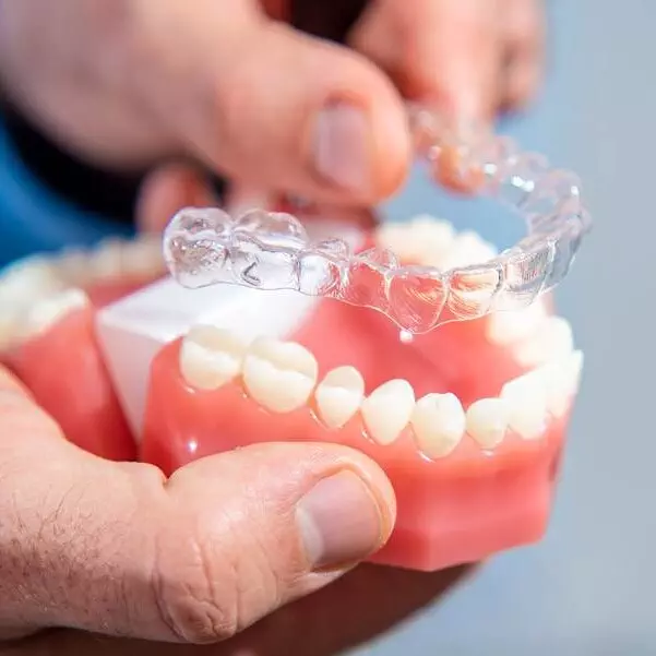 Invisalign smile 03