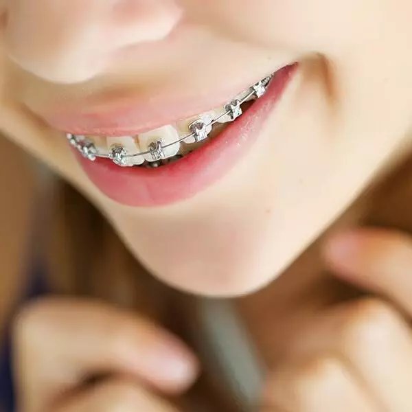Private Orthodontics
